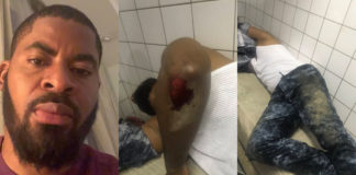 Deji Adeyanju Beaten, Hospitalised As Pro-Buhari Thugs Attack #FreeSowore Protesters