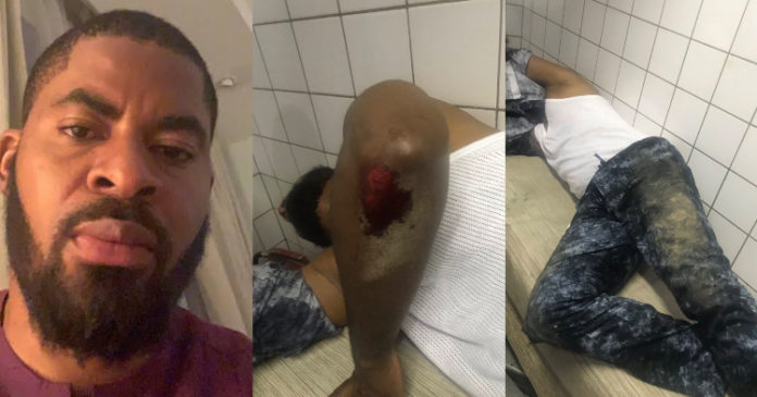 Deji Adeyanju Beaten, Hospitalised As Pro-Buhari Thugs Attack #FreeSowore Protesters