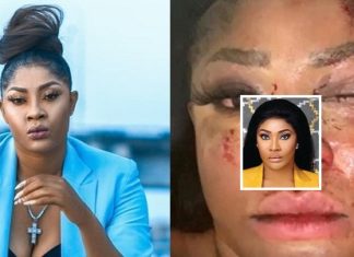 "10 Bullets Removed From My Head, 2 Close To My Eyes" - Angela Okorie Escapes Assassination