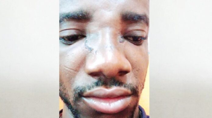 Bolt Driver Who Escaped From Kidnappers After Being Tortured Gets Extorted By SARS Operatives