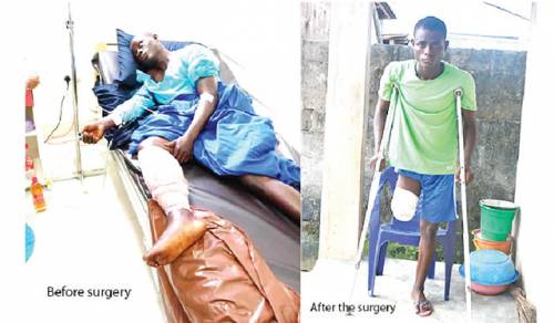 Cobbler: My Leg Was Amputated After I Was Shot At Lekki Toll Gate